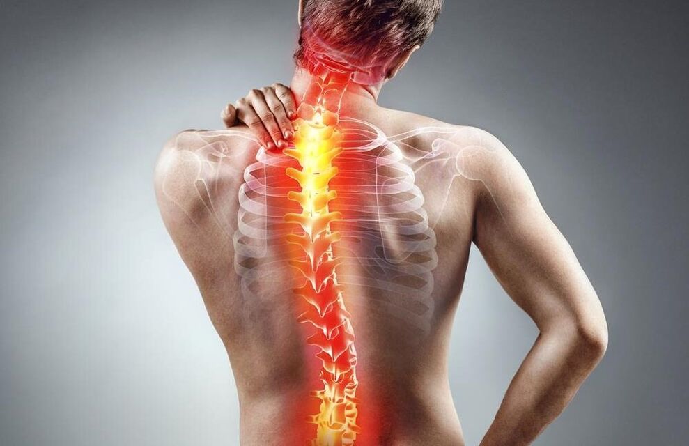 duele la espalda con osteocondrosis