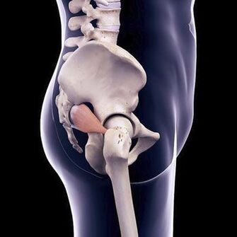 El dolor de espalda en daga puede deberse a un espasmo del músculo piriforme