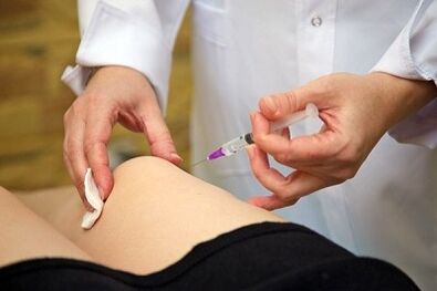 inyecciones para el tratamiento de la artrosis de la articulación de la rodilla