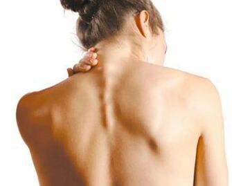 Osteocondrosis cervical una enfermedad grave