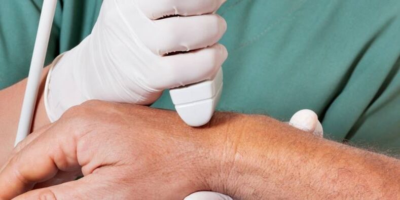 artritis como causas del dolor en las articulaciones de los dedos