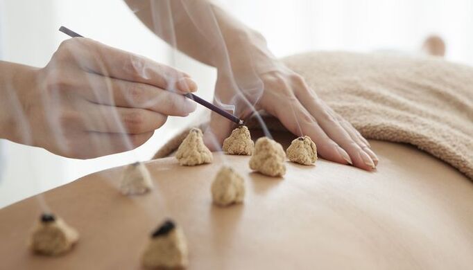 Calentamiento de puntos bioactivos en la espalda para la osteocondrosis.