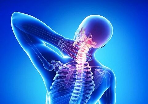 osteocondrosis cervical