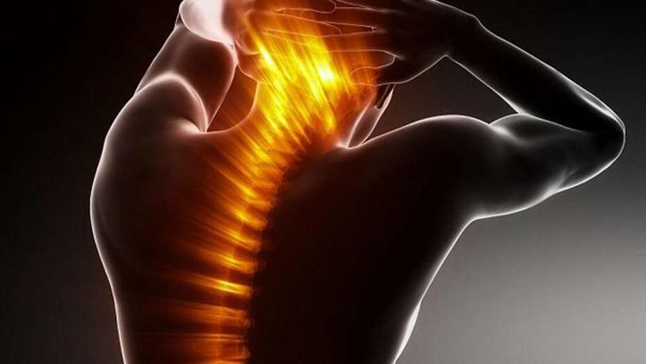 ¿Por qué me duele la espalda